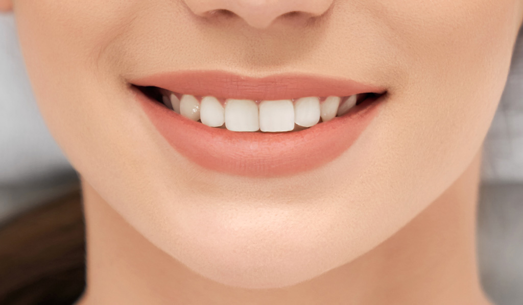 前歯の部分矯正