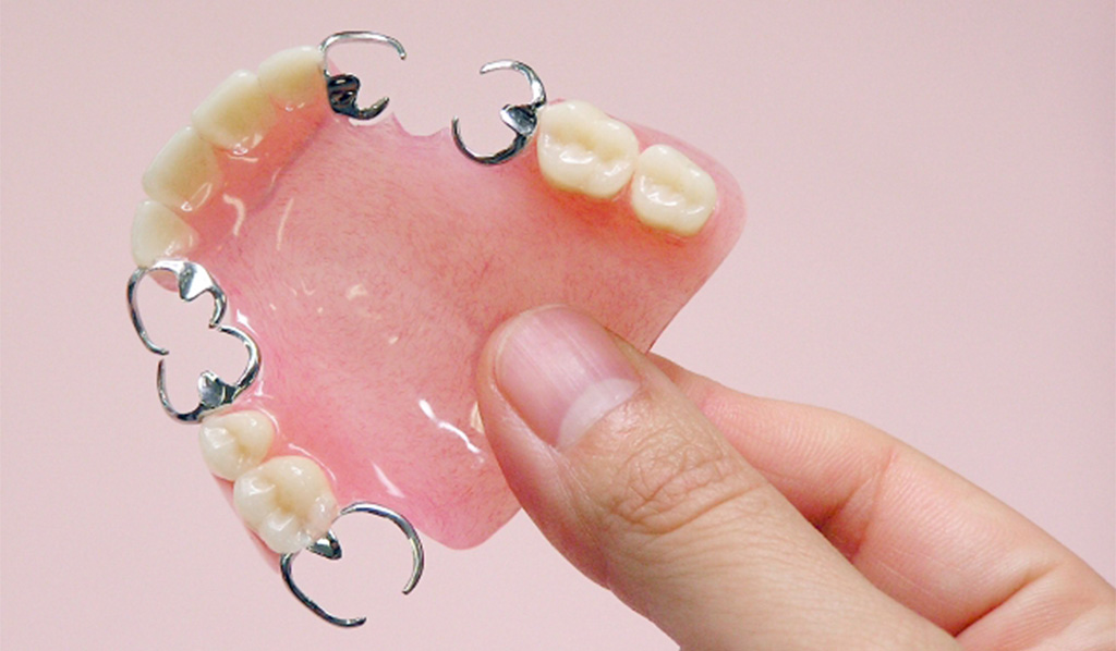 保険レジン床パーシャルデンチャー