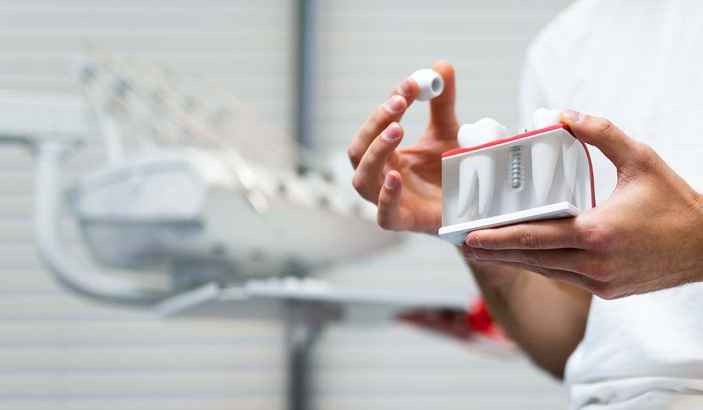 抜けた歯をどう補うかが、「これからの歯を守るカギ」