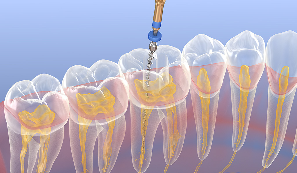 だからこそ、大切に残す治療を。
