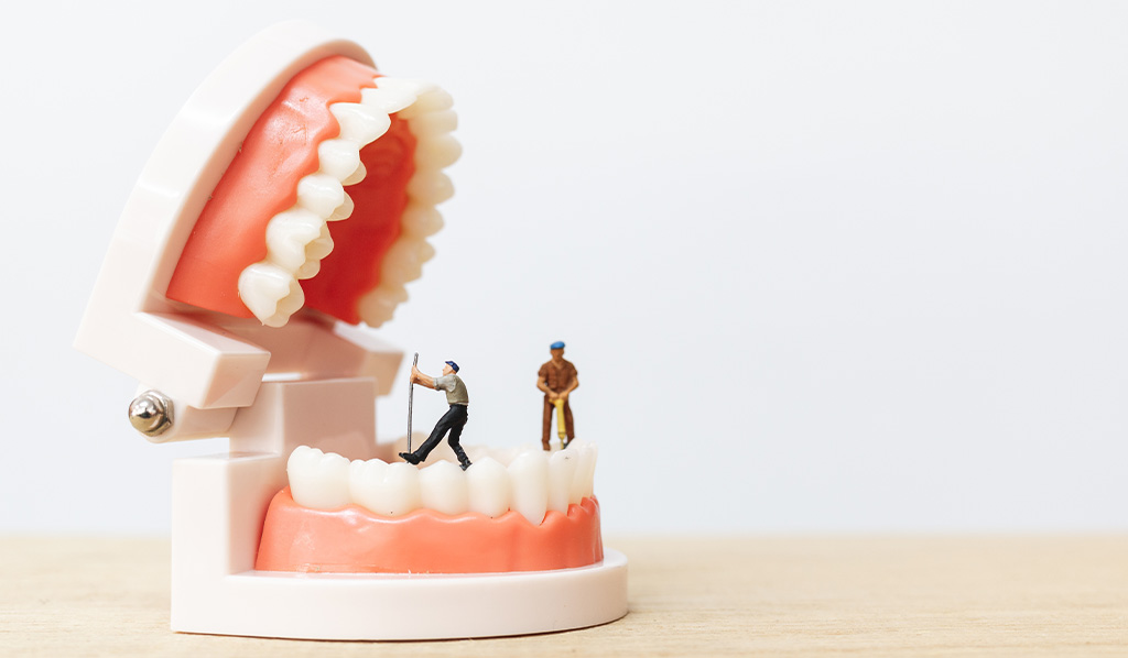 GTR法（組織再生誘導法）